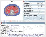 メタボ検査